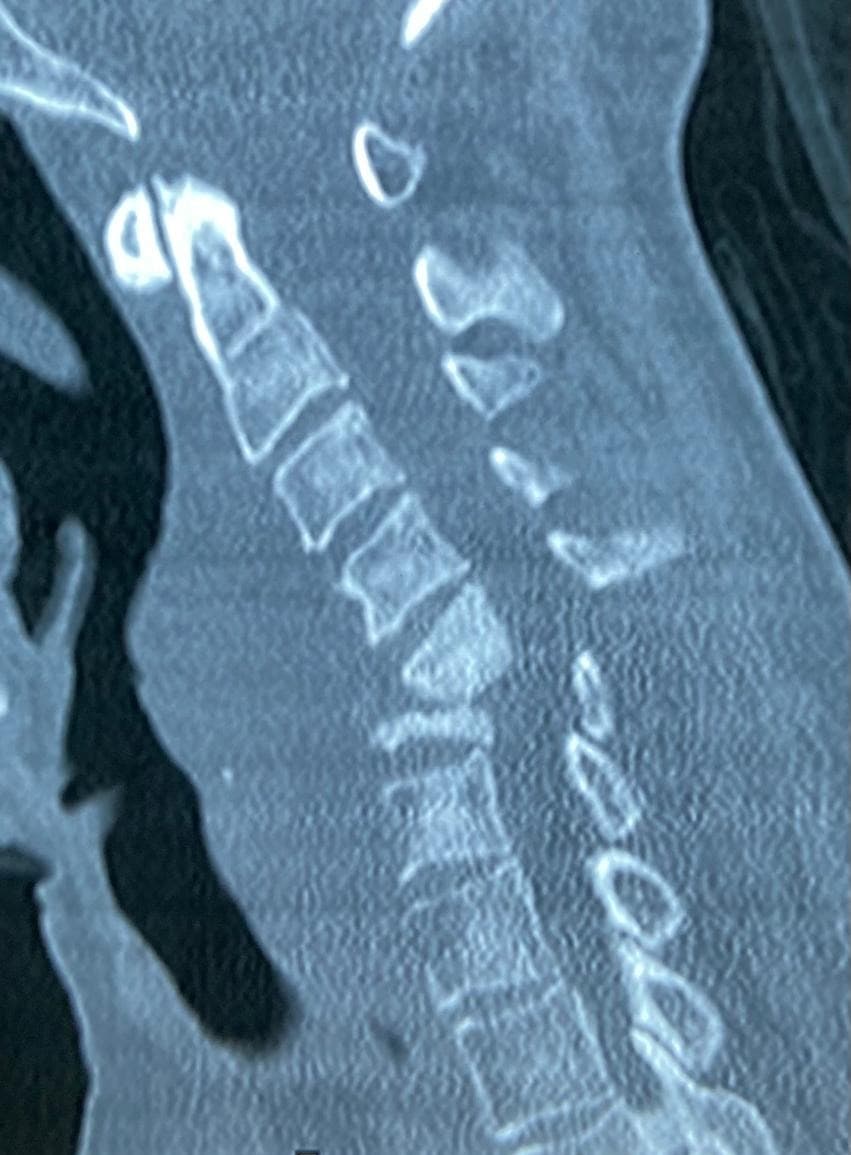 Pre-operation image 2