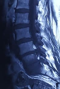 Pre-operation image 2