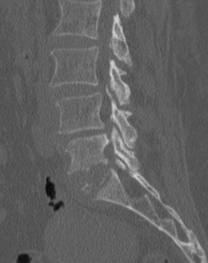 Pre-operation image 3