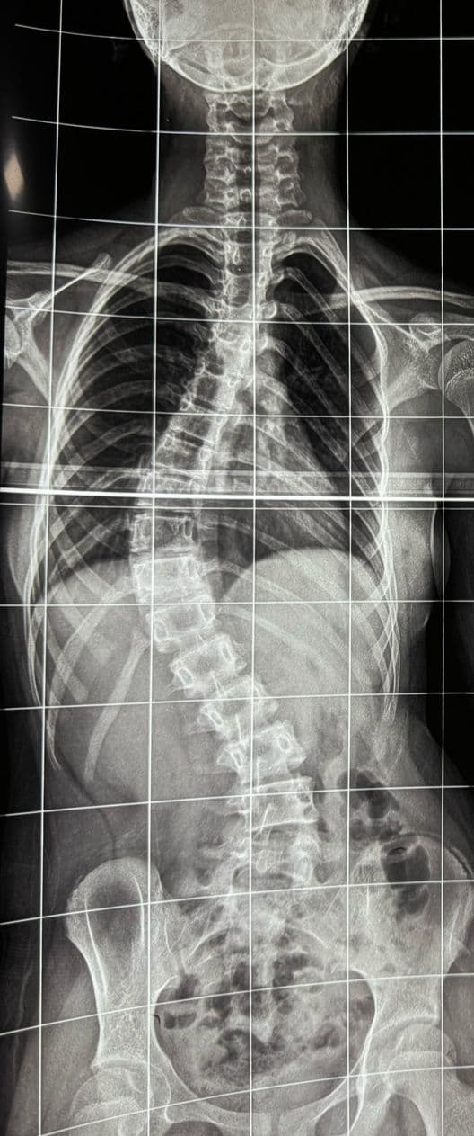 Pre-operation image 1