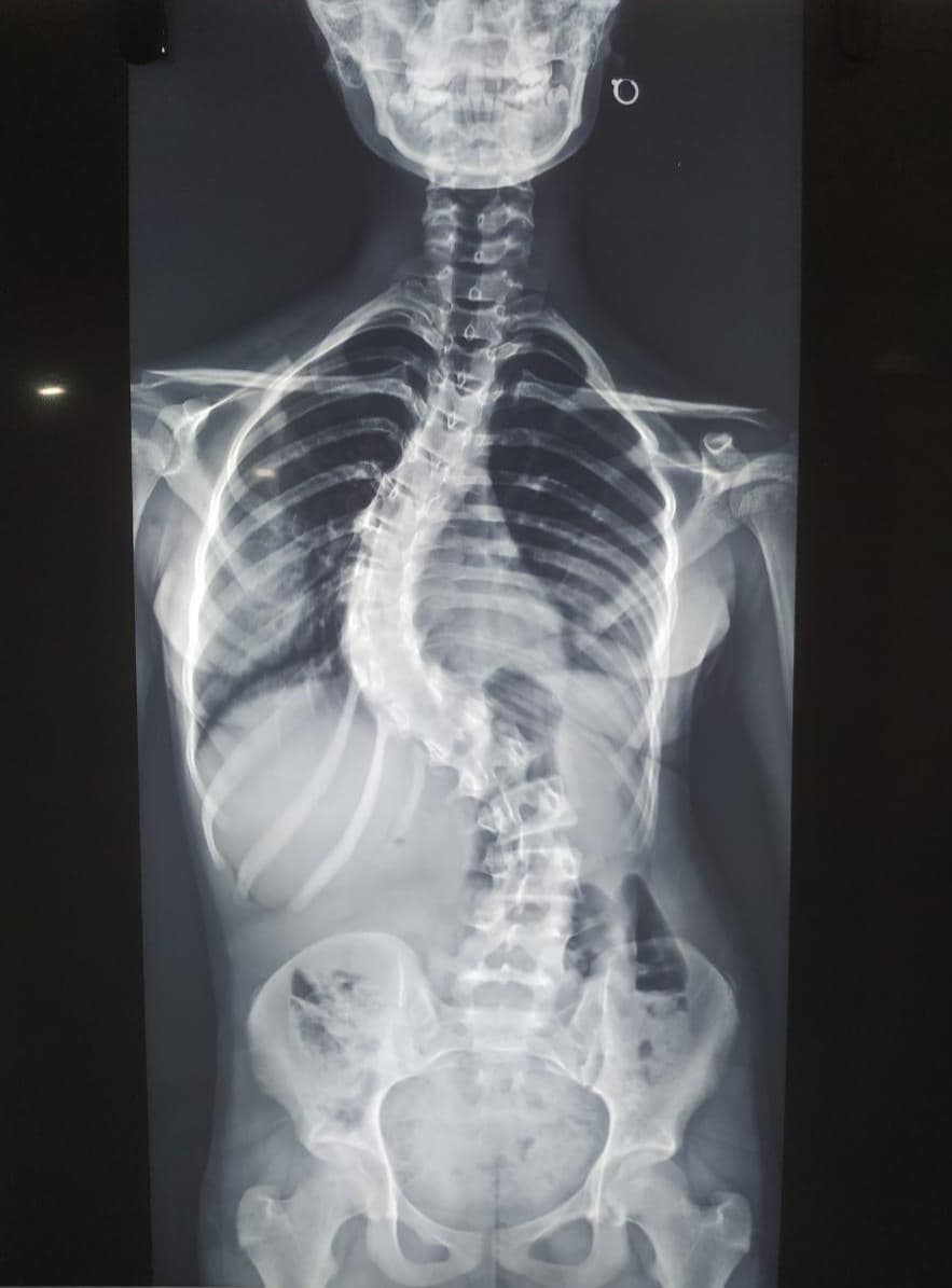 Pre-operation image 1
