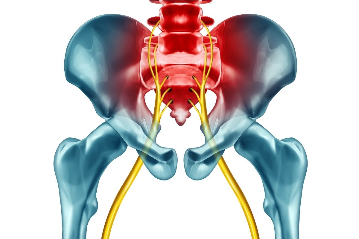 Sciatica – Causes, Symptoms, and Treatments in Kozhikode